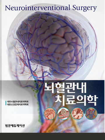 뇌혈관내치료의학 Neurointerventional Surgery